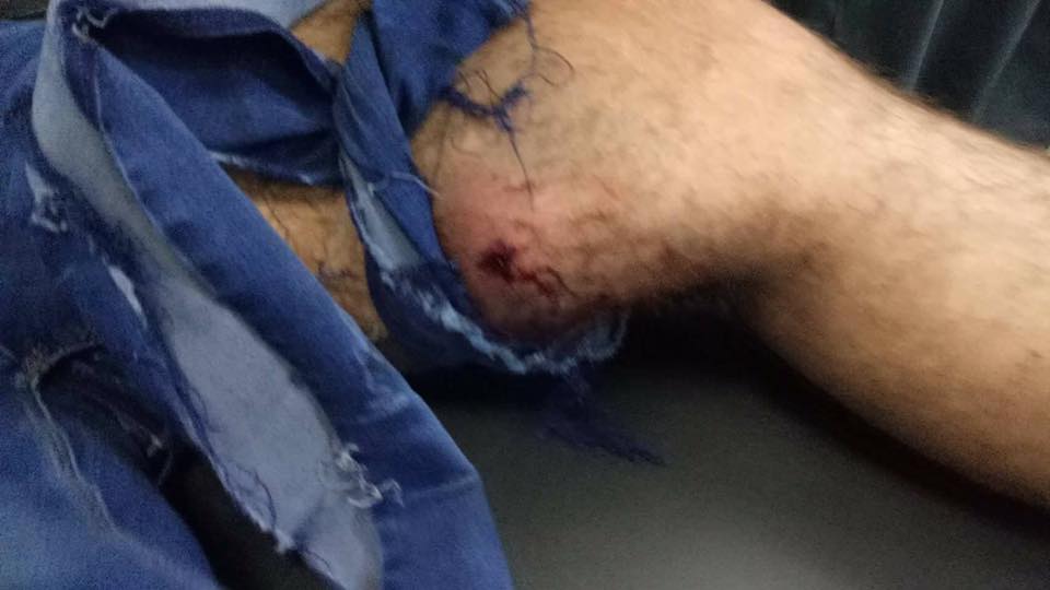 Nine people injured in Erbil following the El Clasico match, Kurdistan Region, April 24, 2017. (Photo: Social Media)